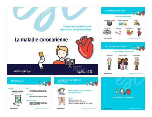 Présentation du Centre d’expertise en maladies chroniques du CISSS de la Montérégie-Est : la maladie coronarienne